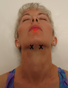 Digastric anterior portion trigger point referral pattern